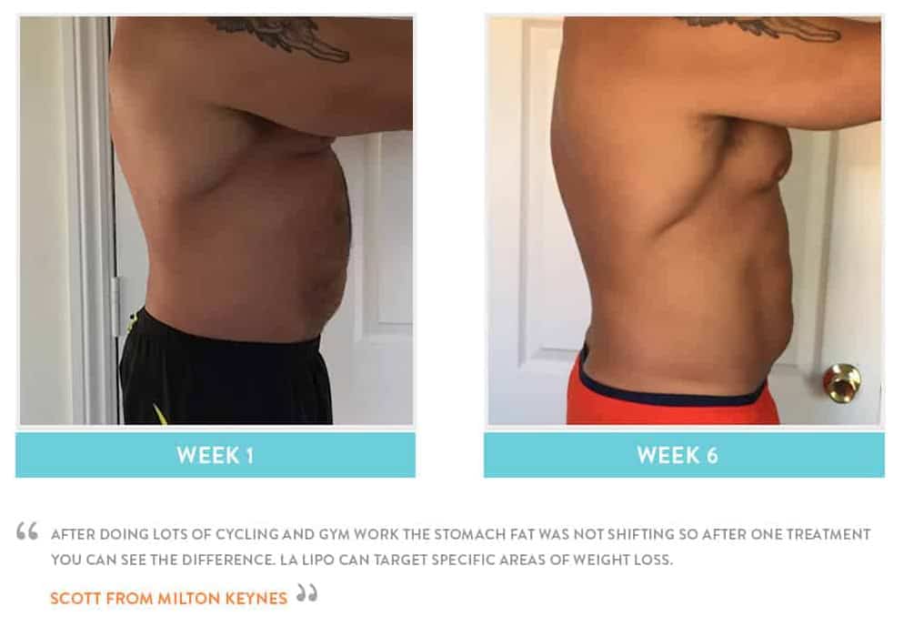 Before & After Stomach Fat Barking