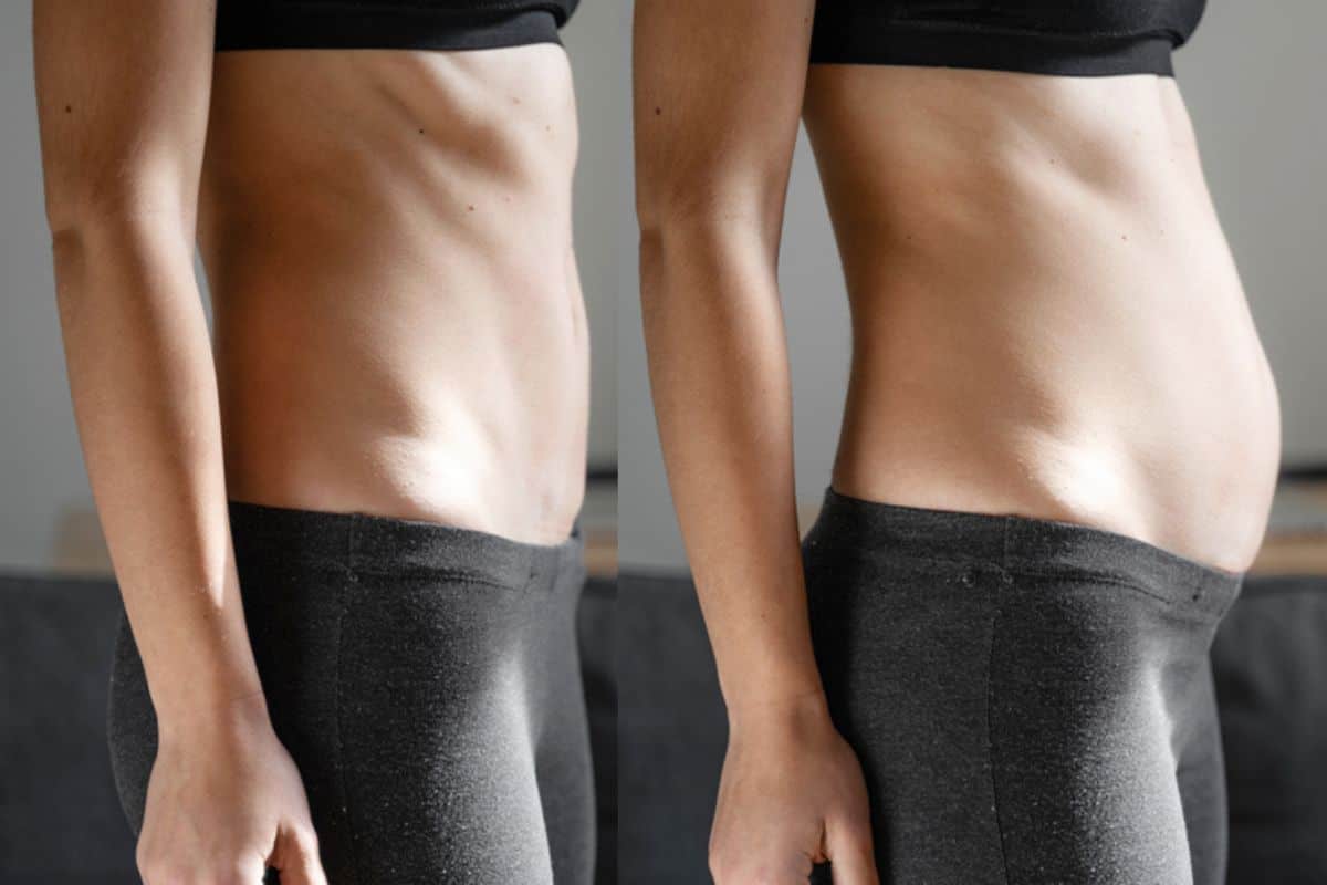 How long does diastasis recti take to improve Barking?