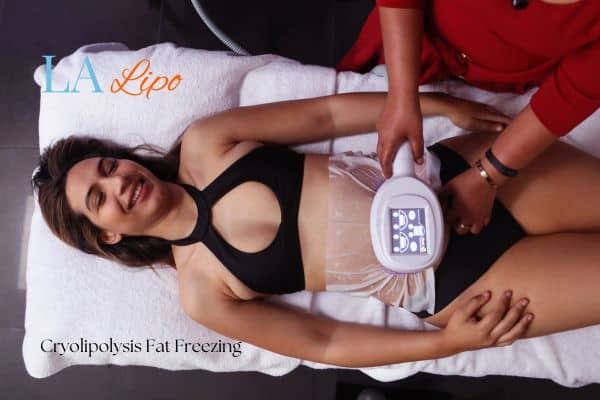 woman getting cryolipolysis Barking