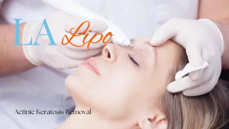 Woman receiving Actinic Keratosis Removal Treatment Barking