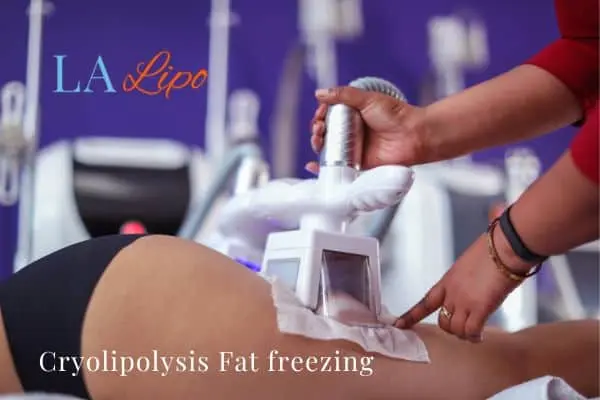 women getting fat freezing Barking