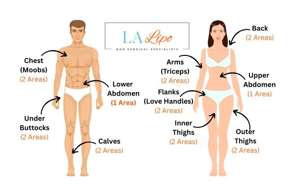 LA LIPO Cryolipolysis Areas Barking