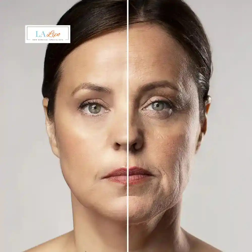 How Can You Tell If Non-Surgical Skin Tightening Is Right for You Barking?