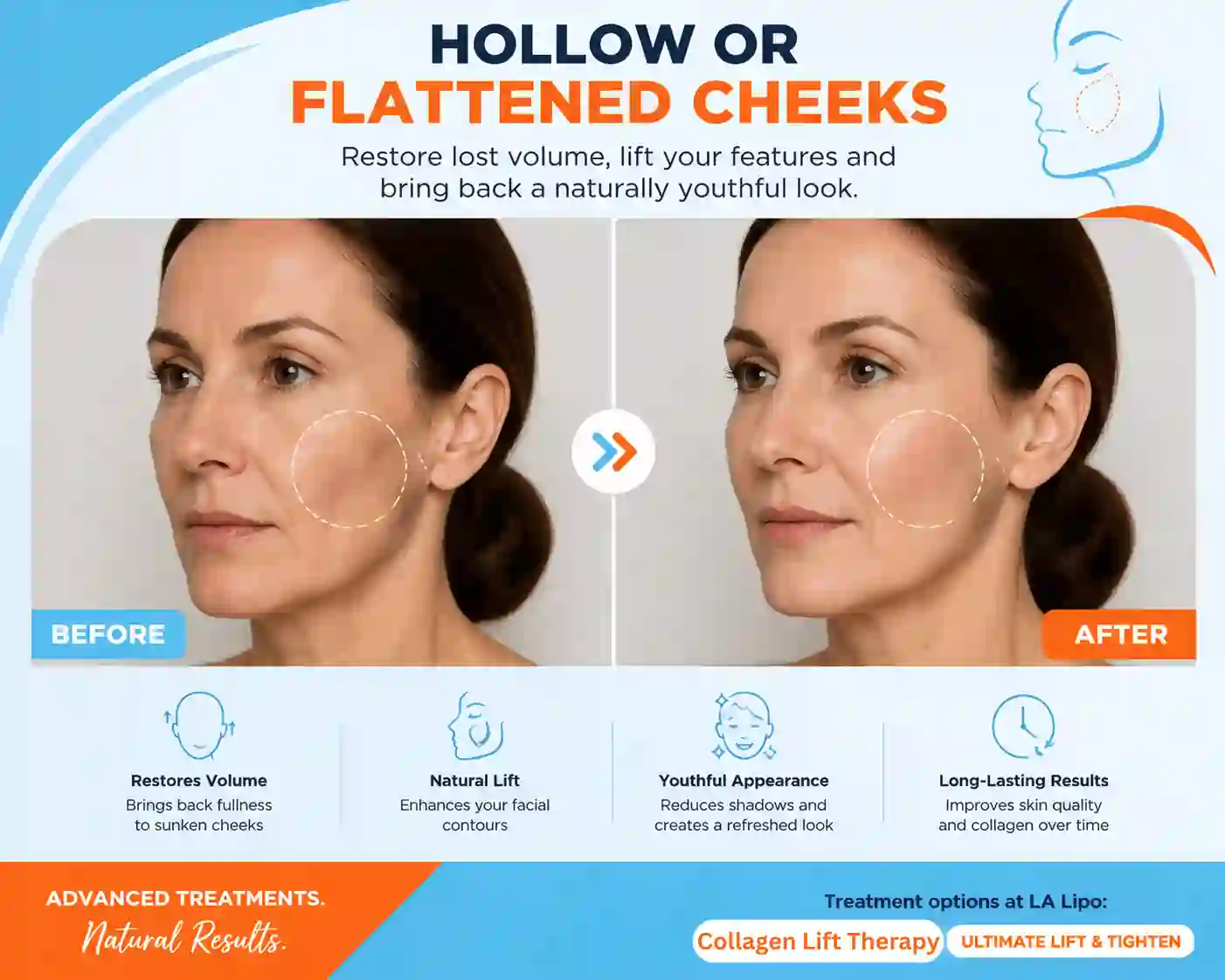Sign #4: Hollow or Flattened Cheeks Barking