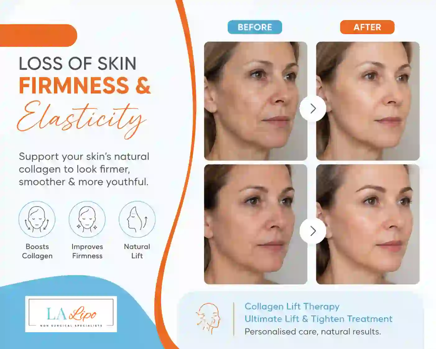 Sign #7: Loss of Skin Firmness and Elasticity Barking